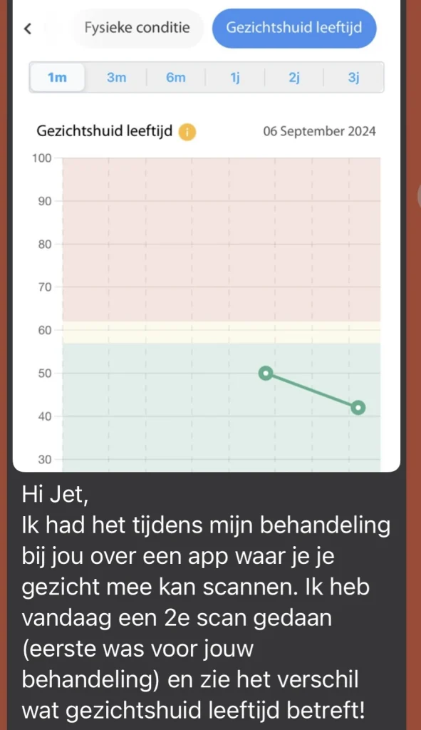 review-8-jaar-jongere-huid